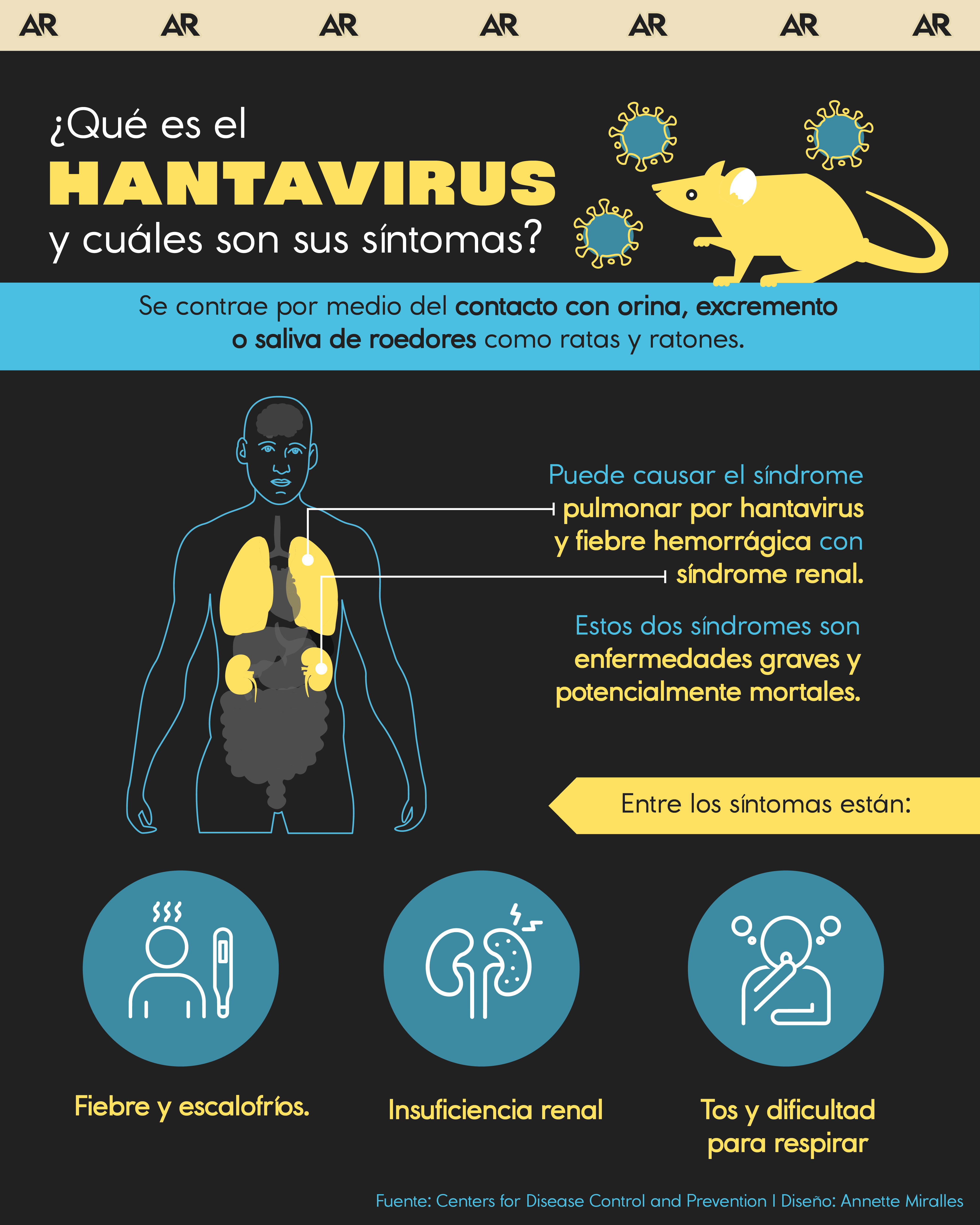 ¿Qué es el Hantavirus y cuáles son sus síntomas?