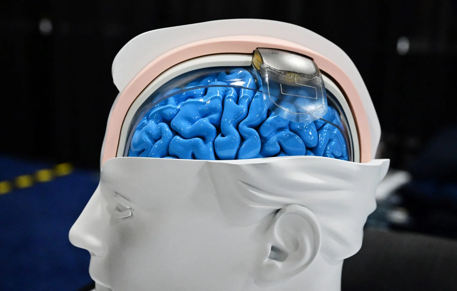 Representación del implante cerebral.