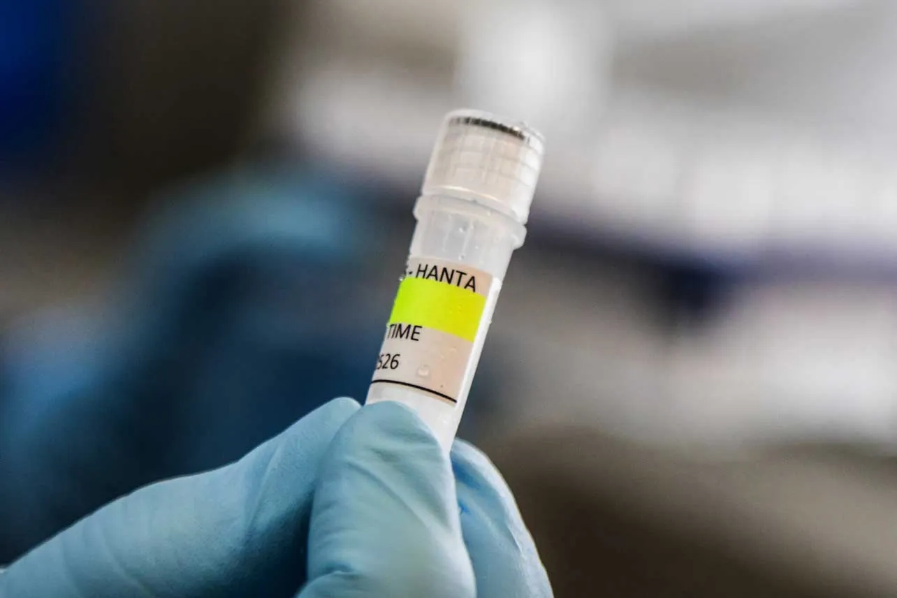 Hantavirus, crucero