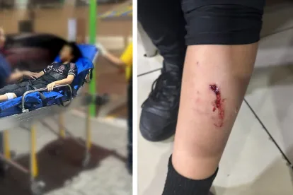 Madre, niño mordido, perro, Multiplaza Escazú, noticias, Costa Rica
