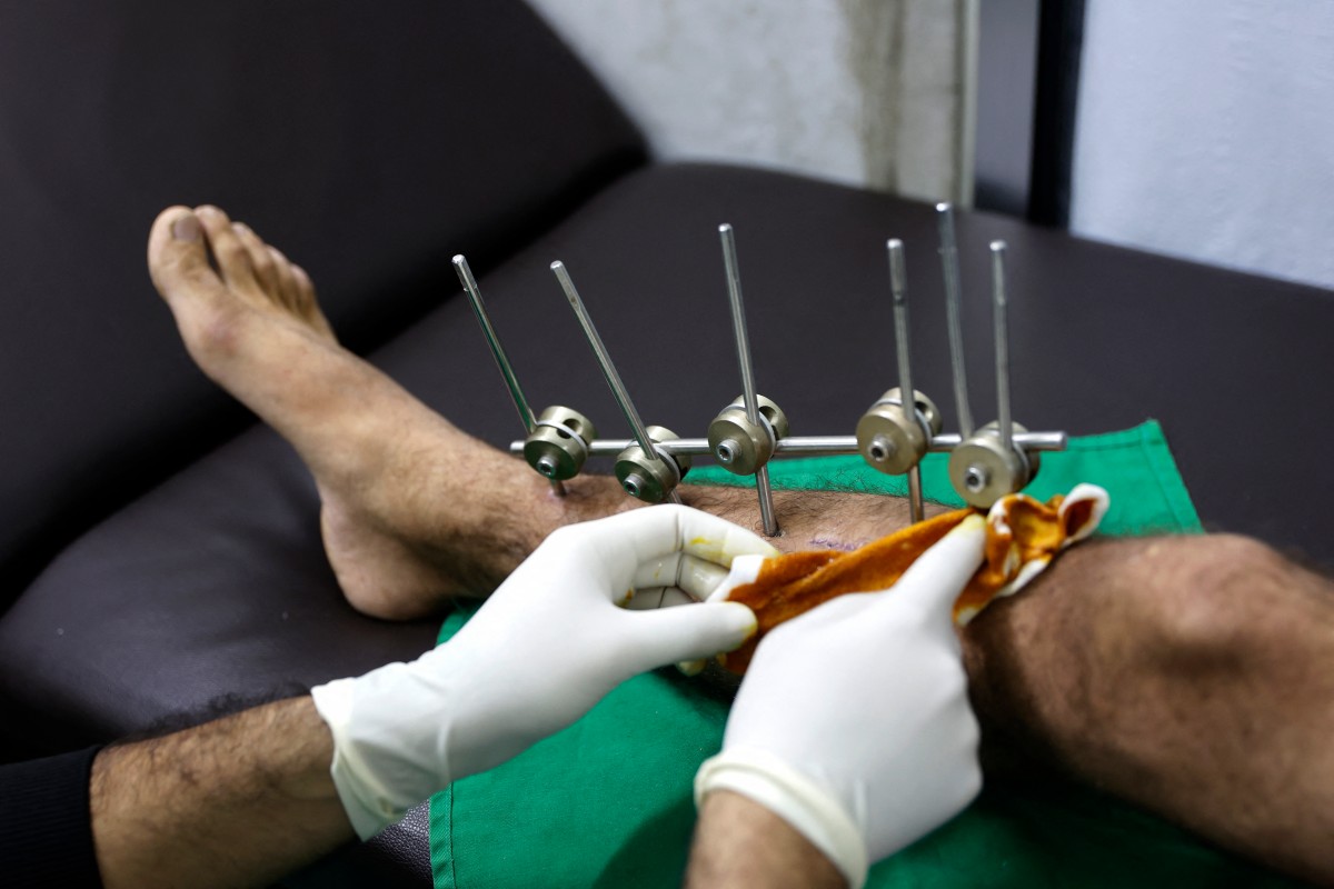 médicos gaza hospital