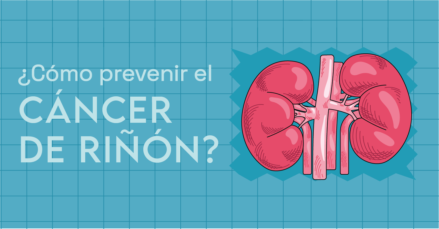 ¿Cómo prevenir el cáncer de riñón?