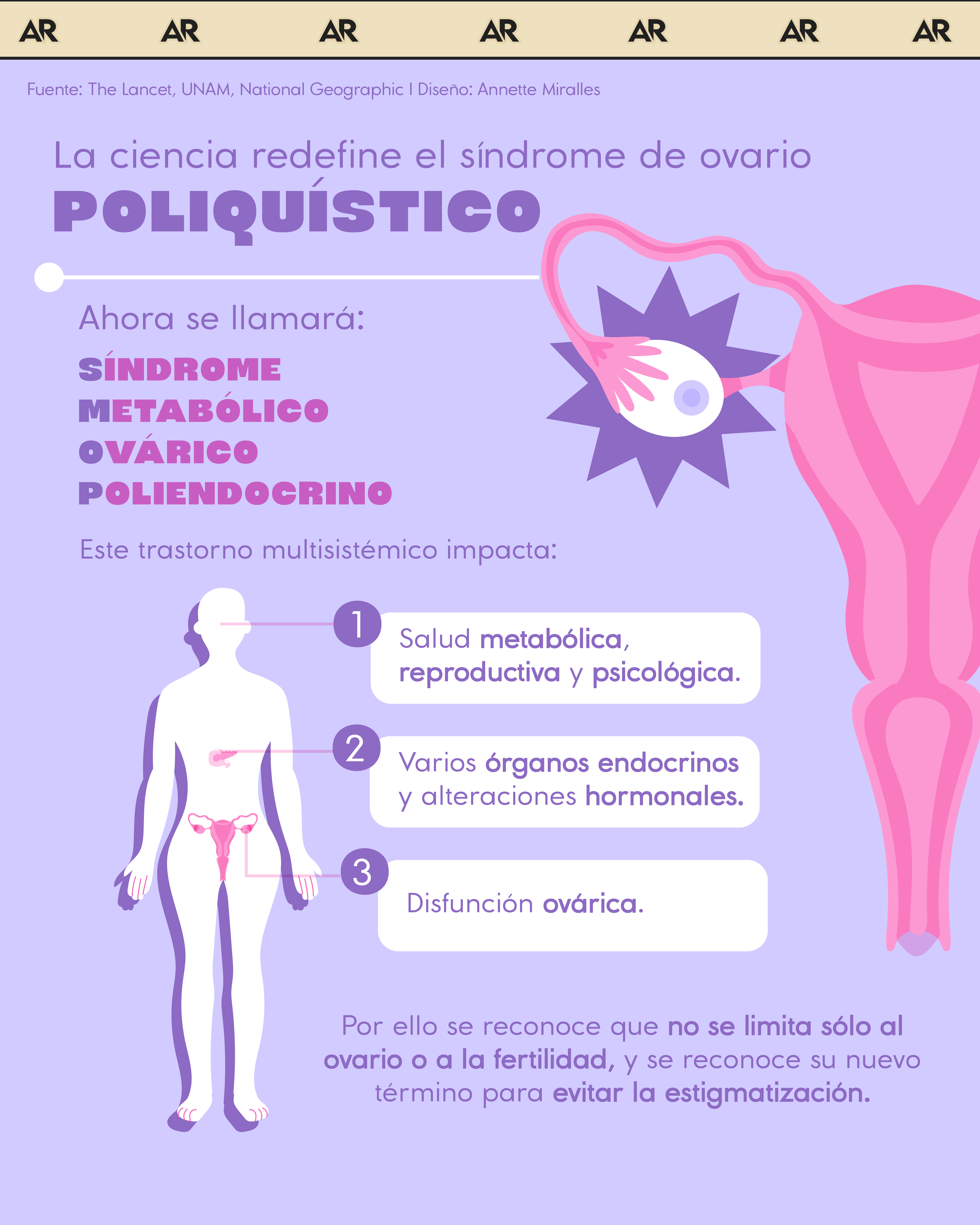 Síndrome Metabólico Ovárico Poliendocrino