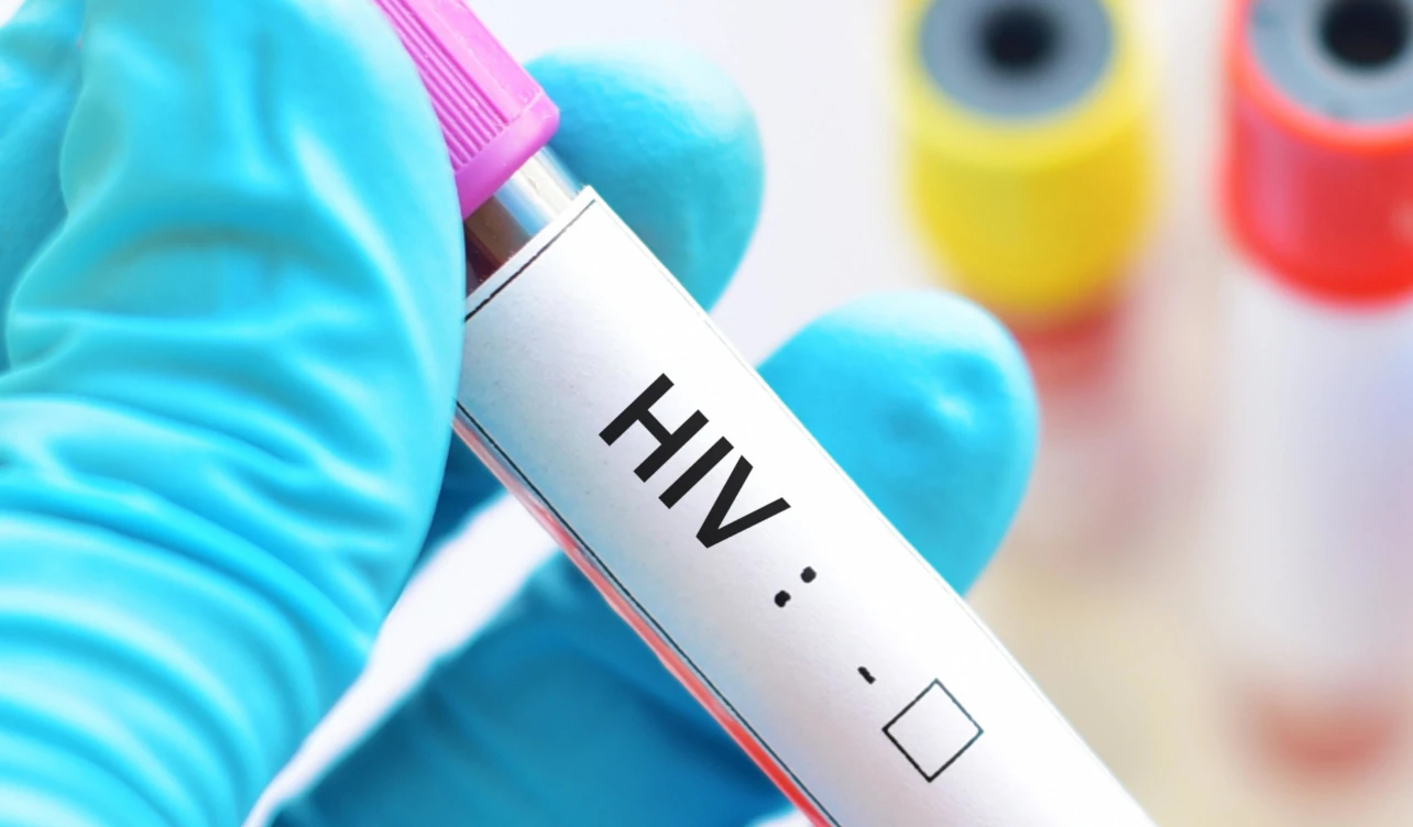 eeuu, aprobación, tratamiento, prevención, vih