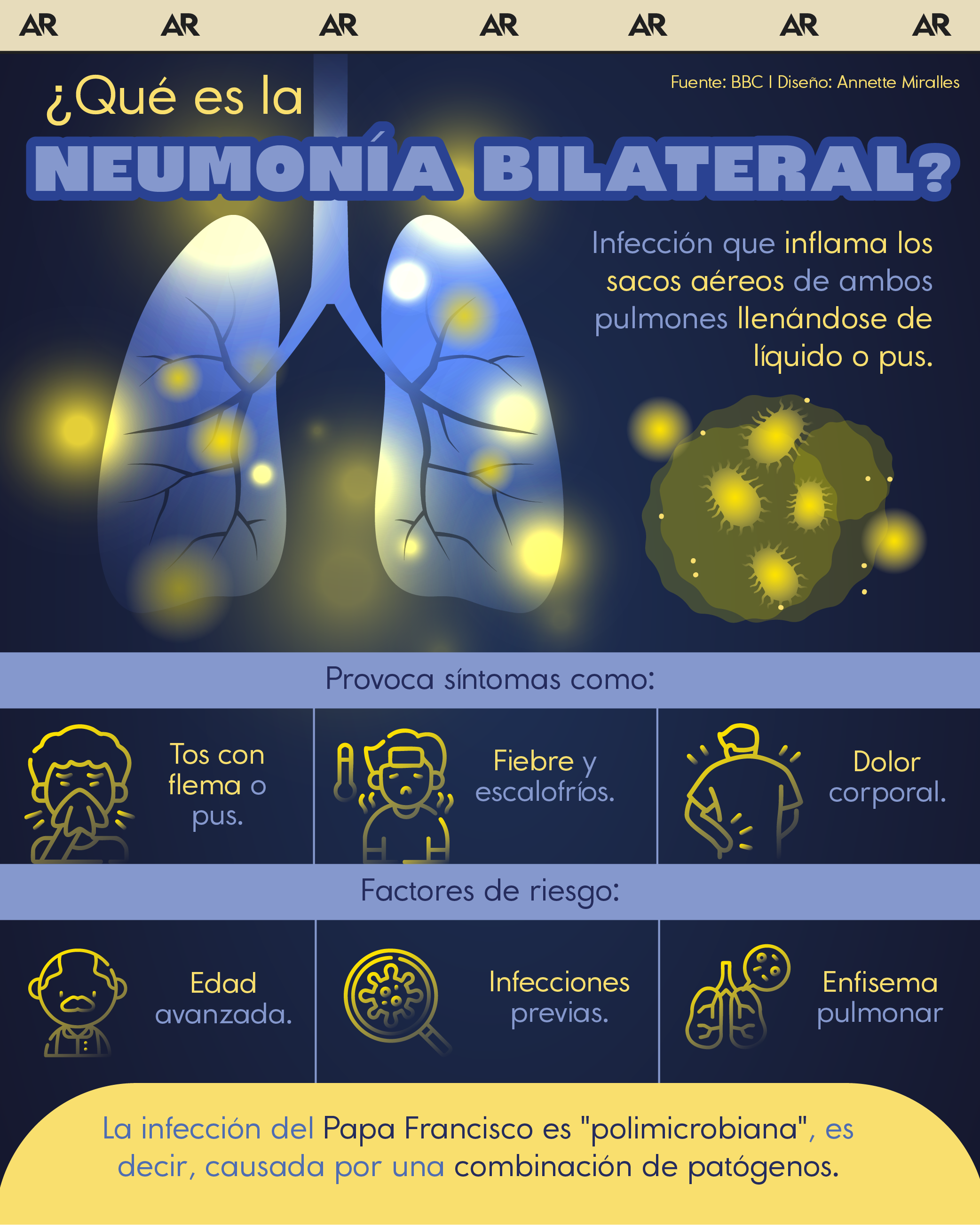 neumonía, pulmones, respiración, Papa, salud, noticias, Costa Rica 