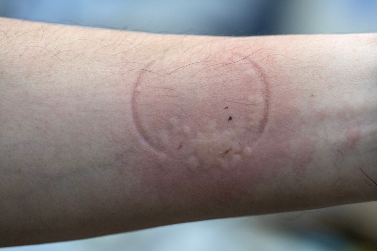 chinches investigación crímenes