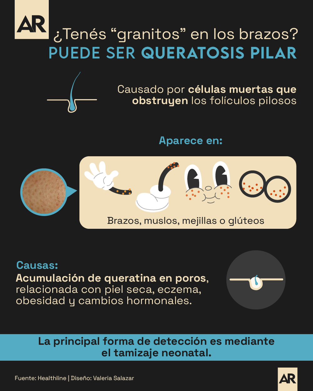 Queratosis pilar, Granitos, Piel