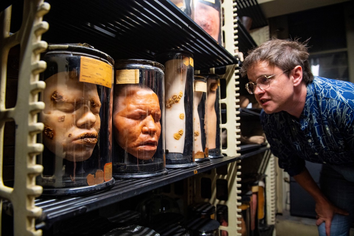 Mütter Museum de Filadelfia