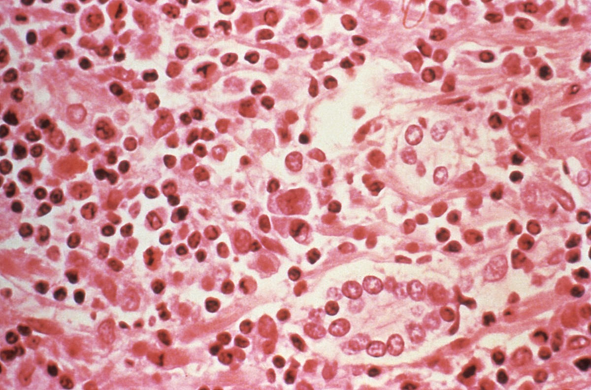 OMS, no cree, hantavirus, sea similar, pandemia