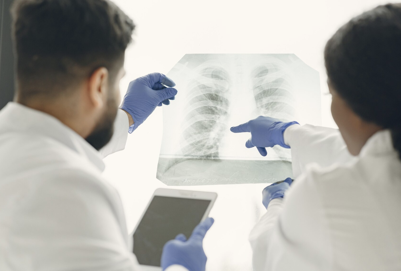 Tuberculosis, OMS